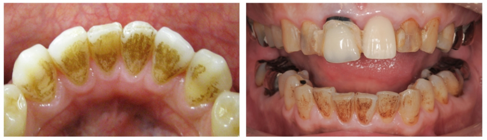 Форма выпуска