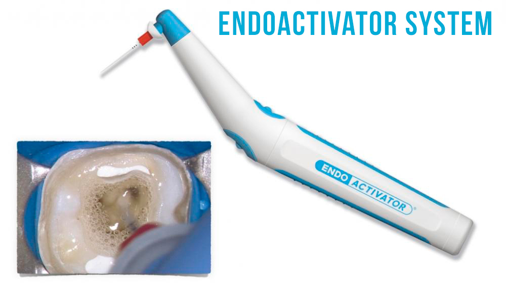 Інструкція з експлуатації стоматологічного Endoactivatora: