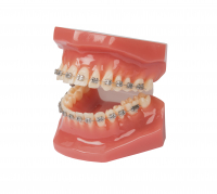Демонстрационная модель зубов с брекетами Paro Swiss