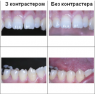 Контрастера L, для передних зубов (YDM)