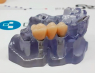 Тимчасова конструкція DIGITAG TAG Dental