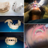 Временная конструкция DIGITAG TAG Dental