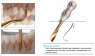 Easy Twist Luxator 3115 (Dental Studio) Легкий твіст люксатор (кутовий)