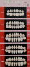 Гарнитур жевательных зубов в тубах Стома ЭСТЕДЕНТ - 02 (40 гарнитур)