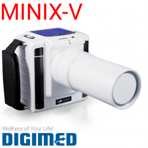 Рентген Digi Med MINIX-V