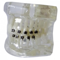 Демонстрационная модель, ортодонтическая XINGXING, Четыре вида брекетов М3013