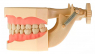 Модель тренировочная со съёмными зубами (нижняя и верхняя челюсть) HTS-A7-01