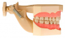 Модель тренувальна зі знімними зубами (нижня та верхня щелепа) HTS-A7-01