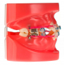 Модель демонстрационная ортодонтическая с керамическими брекетами HTS-B1-03