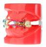Модель демонстрационная ортодонтическая с керамическими брекетами HTS-B1-03