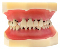 Модель демонстрационная (пародонт+ортопедия+ортодонтия) HST-L4