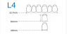 Планка передніх нижніх зубів HUGE Kaili L4 (6 шт)