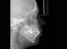 Orthophos S 3D Ceph, 8х8 (Sirona) Рентген томограф с цефалостатом