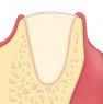 Derma (OsteoBiol) Мембрана