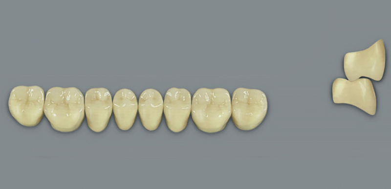 MFT (VITA) Гарнітур зубів, нижні бічні, колір 2L1.5