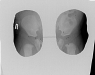 Пластина рентгенозащитная тазобедренная СИЗ-Р Онико (детская) Pb=0,5