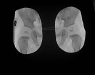 Пластина рентгенозахисна тазостегнова ЗІЗ-Р Оніко (дитяча) Pb=0,5