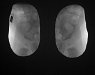 Пластина рентгенозахисна тазостегнова ЗІЗ-Р Оніко (дитяча) Pb=0,5