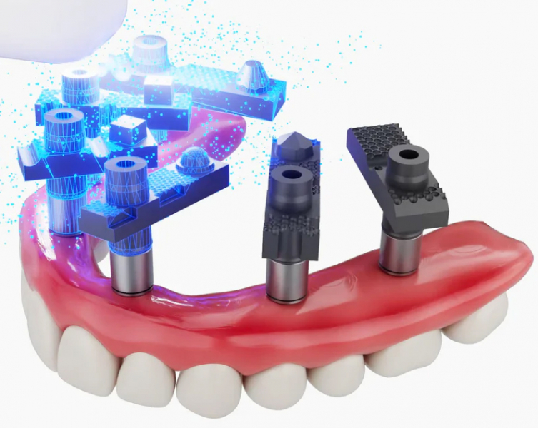 Scan Ladder Direct Titanium - Набор титановых скан-боди, 8 шт