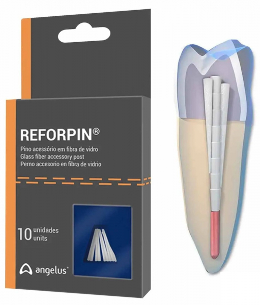 Штифти скловолоконні Angelus Reforpin, клиноподібні, 10 шт