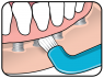 Специальная зубная щетка TePe Compact Tuft (блистер) 304-0074