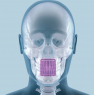 X-VIEW 3D (Trident Dental) Панорамный томограф