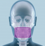 X-VIEW 3D (Trident Dental) Панорамний томограф