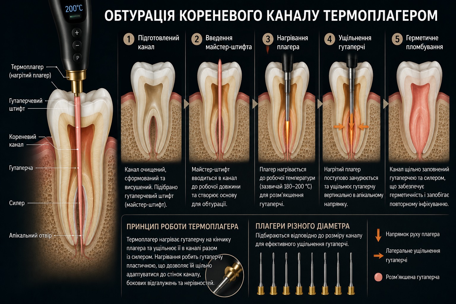 що таке термоплагер