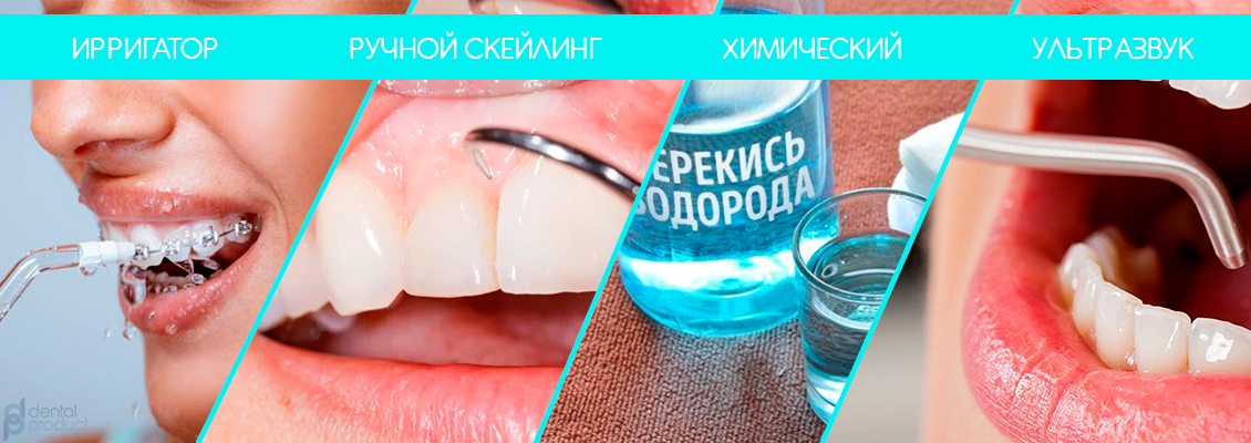 процедура удаление зубных отложений