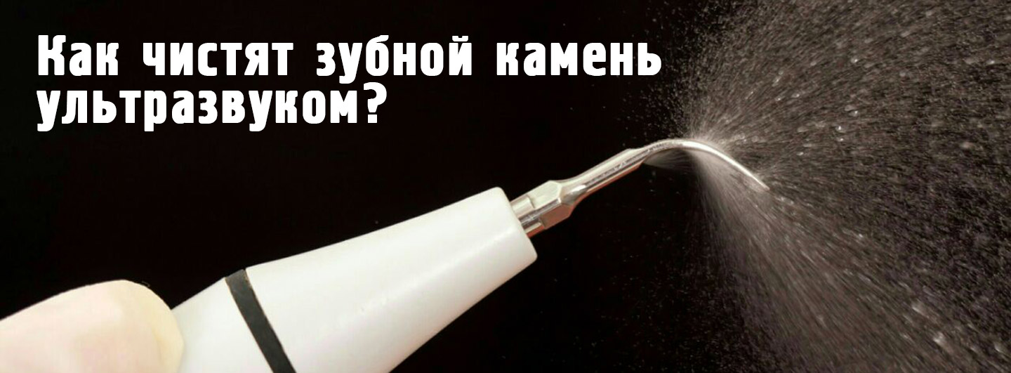 чистка зубов ультразвуком чистка зубов ультразвуком