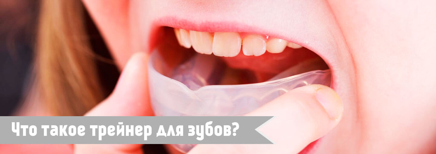 что такое трейнер для зубов?